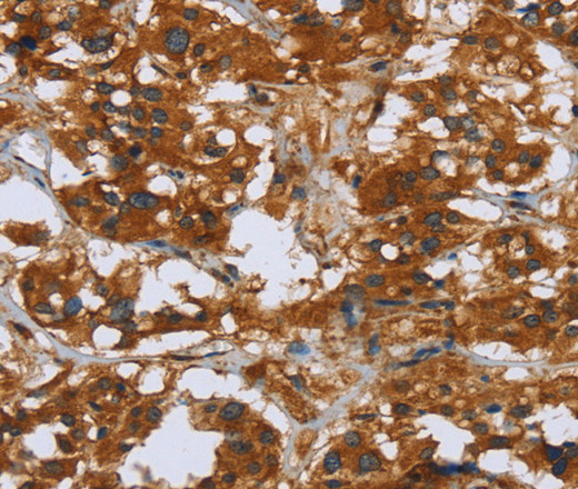 COMP Polyclonal Antibody (E-AB-14886)