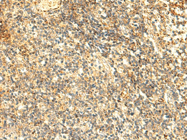 NAPRT Polyclonal Antibody (E-AB-18968)
