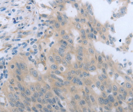 TNK2 Polyclonal Antibody (E-AB-15457)