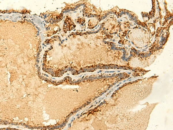 GLYATL2 Polyclonal Antibody (E-AB-52873)