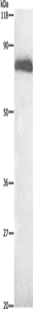 ALB Polyclonal Antibody (E-AB-10001)