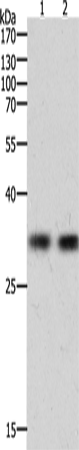 HAVCR1 Polyclonal Antibody (E-AB-15501)