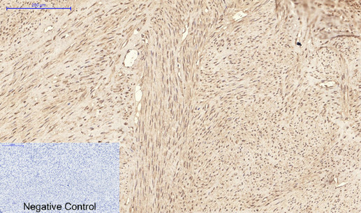 ATG7 Monoclonal Antibody (E-AB-22151)