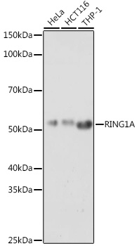 RING1A Polyclonal Antibody (E-AB-92186)