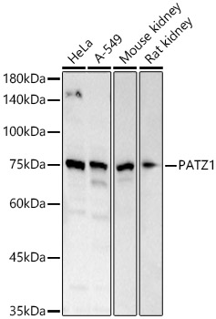 PATZ1 Polyclonal Antibody (E-AB-90051)