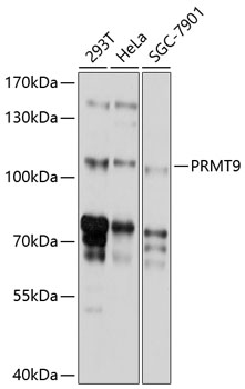 PRMT9 Polyclonal Antibody (E-AB-90185)