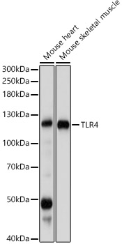 TLR4 Polyclonal Antibody (E-AB-68273)