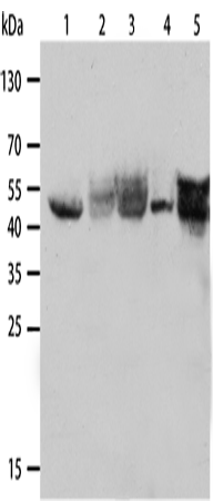 CK-19 Polyclonal Antibody (E-AB-10120)