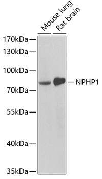 NPHP1 Polyclonal Antibody (E-AB-61290)