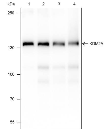 Recombinant KDM2A Monoclonal Antibody (AN301693L)