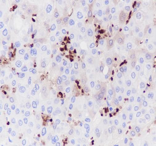 Recombinant Hemoglobin Alpha Monoclonal Antibody (AN301545L)