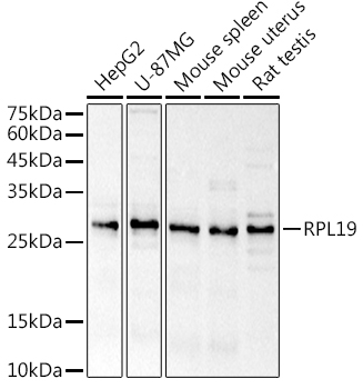 RPL19 Polyclonal Antibody (E-AB-92290)