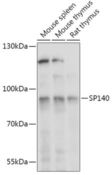 SP140 Polyclonal Antibody (E-AB-91843)
