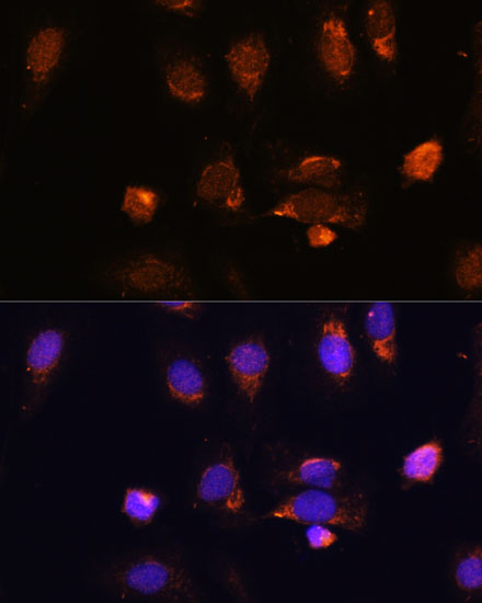 RPL34 Polyclonal Antibody (E-AB-66545)