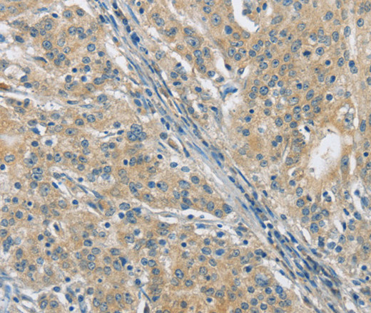 PKD1 Polyclonal Antibody (E-AB-12437)