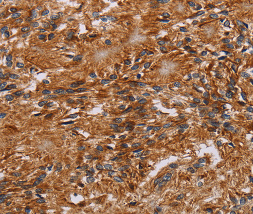 JAKMIP2 Polyclonal Antibody (E-AB-15144)