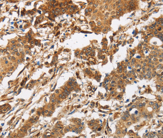 CALU Polyclonal Antibody (E-AB-11023)