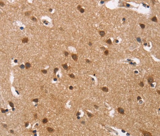 Cav1.3 Polyclonal Antibody (E-AB-16291)