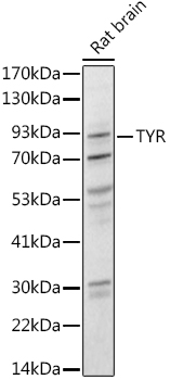 TYR Polyclonal Antibody (E-AB-60286)