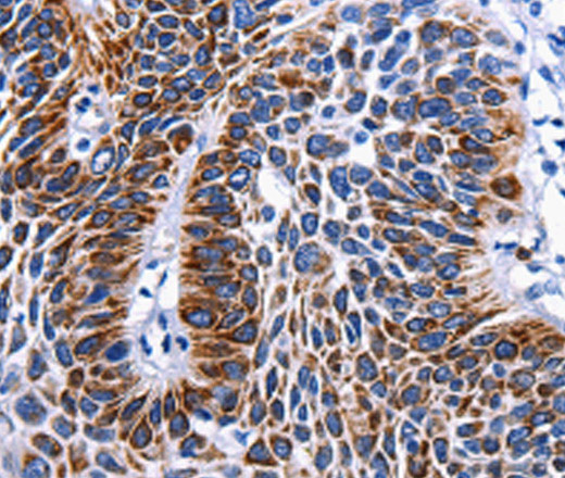 RAB25 Polyclonal Antibody (E-AB-15466)