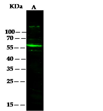 Recombinant SerpinF2 Monoclonal Antibody (AN300314P)