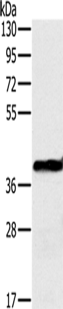 OTC Polyclonal Antibody (E-AB-15274)