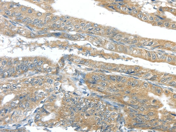 AKT2 Polyclonal Antibody (E-AB-17394)