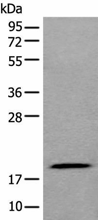 ZNHIT1 Polyclonal Antibody (E-AB-18329)