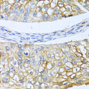 BMP4 Polyclonal Antibody (E-AB-64076)