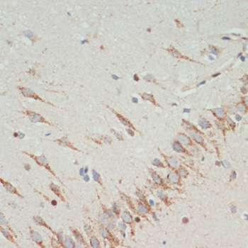 TH Polyclonal Antibody (E-AB-65959)