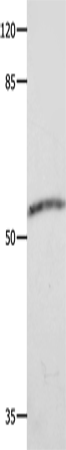 CAP2 Polyclonal Antibody (E-AB-10200)