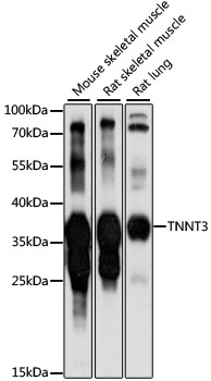 TNNT3 Polyclonal Antibody (E-AB-91119)