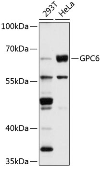 GPC6 Polyclonal Antibody (E-AB-92491)