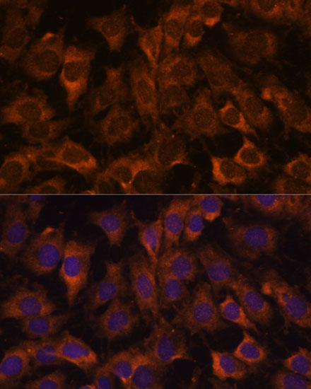 SEC23B Polyclonal Antibody (E-AB-65211)