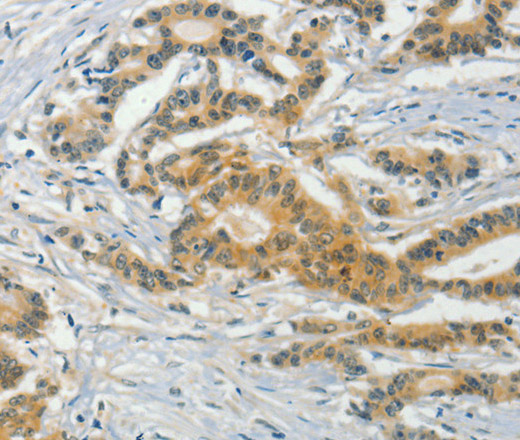 ASB8 Polyclonal Antibody (E-AB-10961)