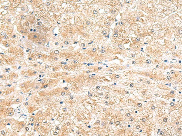 LRG1 Polyclonal Antibody (E-AB-18991)