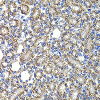 COPS2 Polyclonal Antibody (E-AB-61482)