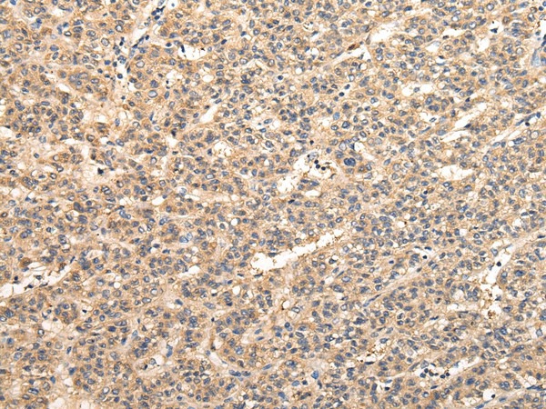 VPS33B Polyclonal Antibody (E-AB-17278)