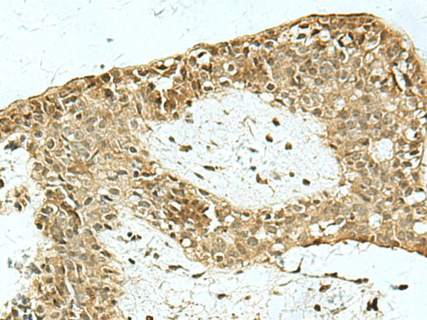 KAT7 Polyclonal Antibody (E-AB-18160)