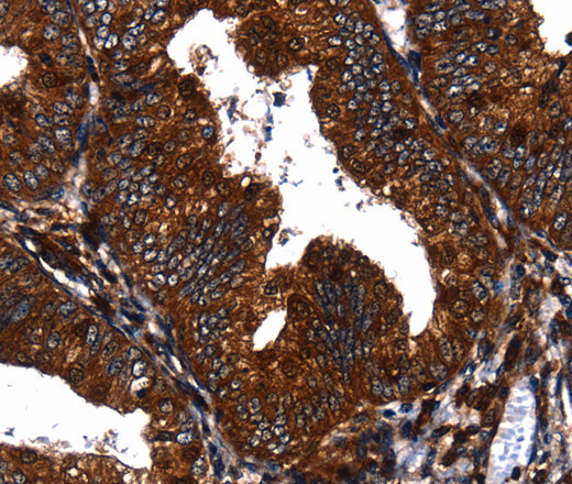EGF Polyclonal Antibody (E-AB-10297)