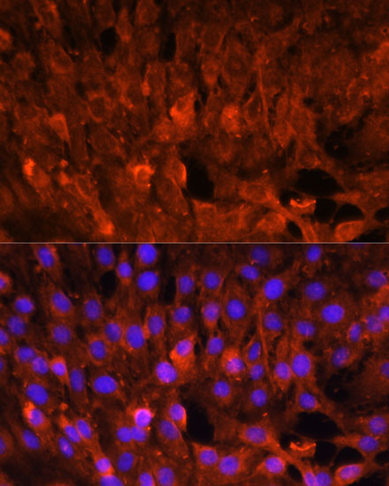 CISH Polyclonal Antibody (E-AB-66300)
