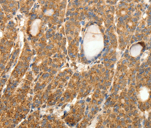 SYT11 Polyclonal Antibody (E-AB-10622)