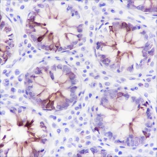 Recombinant MUC4 Monoclonal Antibody (AN301419L)