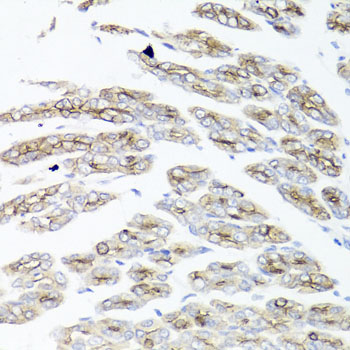 IER3 Polyclonal Antibody (E-AB-63884)
