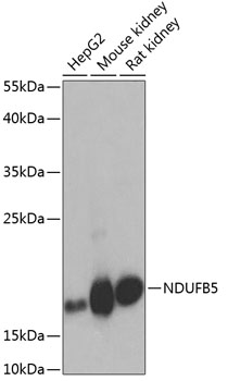 NDUFB5 Polyclonal Antibody (E-AB-62143)