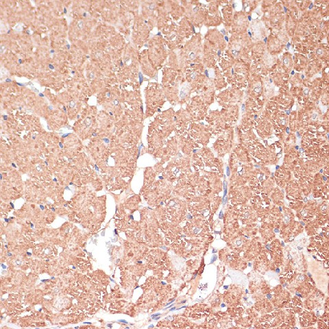 FRMD6 Polyclonal Antibody (E-AB-68041)
