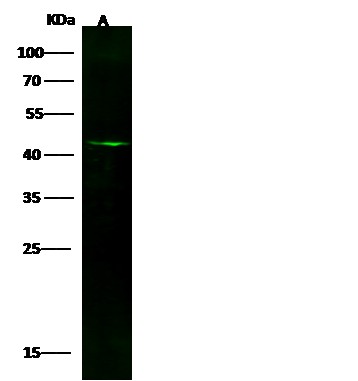 Recombinant GFAP Monoclonal Antibody (AN300140P)