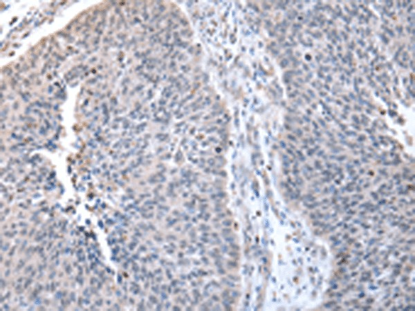 ZNF23 Polyclonal Antibody (E-AB-18325)