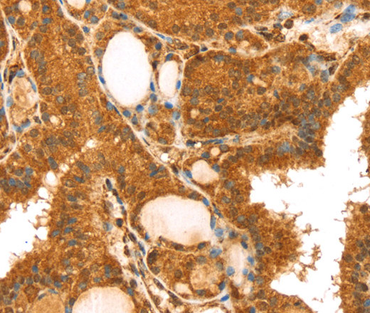 TRIM25 Polyclonal Antibody (E-AB-13732)