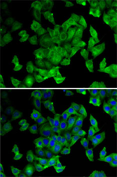 PPL Polyclonal Antibody (E-AB-61425)
